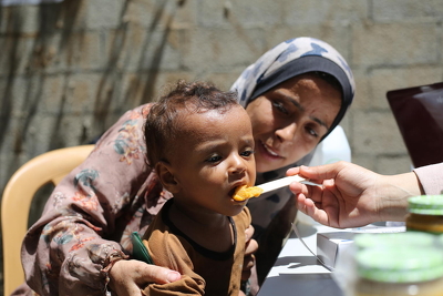© UNICEF/UNI851516/El Baba ガザ地区中部で、ユニセフが届けた栄養支援物資を口にする子ども